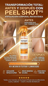 DR. MELAXIN PEEL SHOT (Kojic Acid + Turmeric Spray)