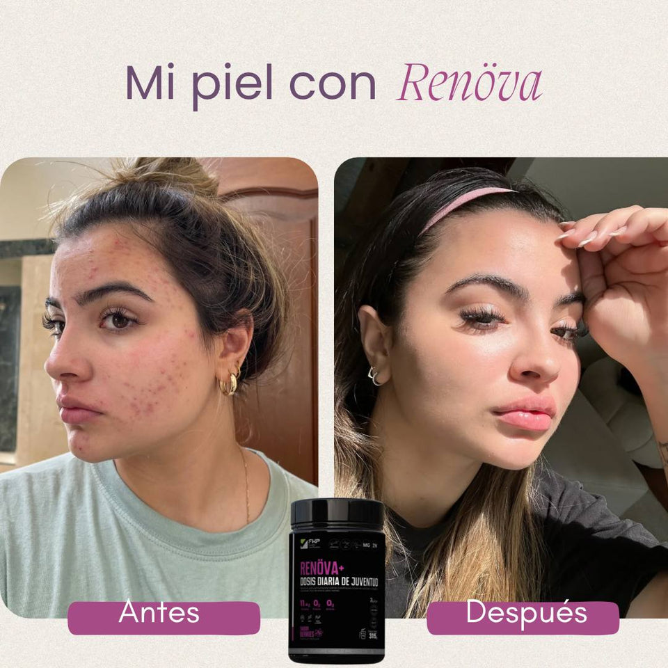 COLÁGENO RENOVA+ CON BIOPEPTIDOS ACTIVOS