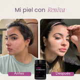 COLÁGENO RENOVA+ CON BIOPEPTIDOS ACTIVOS